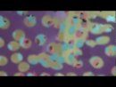 Expand Video